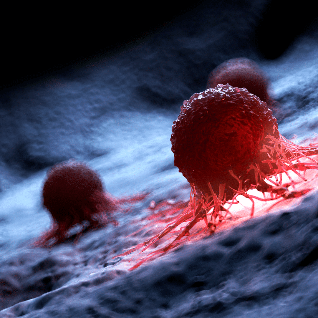 Cellule cancéreuse
