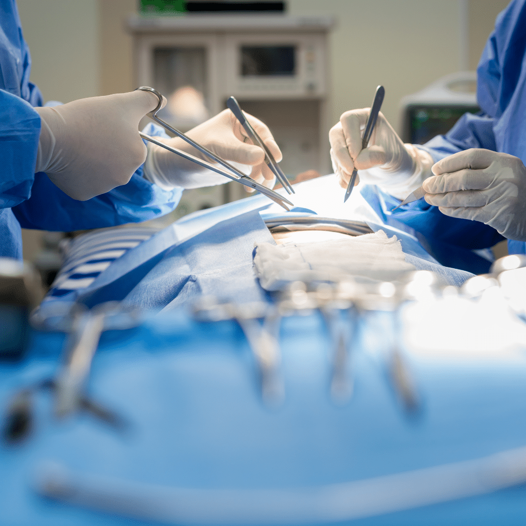 Surgical removal of a tumor
